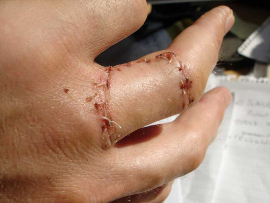 The realities of dropping a railway sleeper onto your finger. Railwaysleepers.com