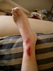 dropping a railway sleeper onto your foot is very painful. Railwaysleepers.com